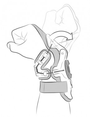 Mobius Wrist Brace X8